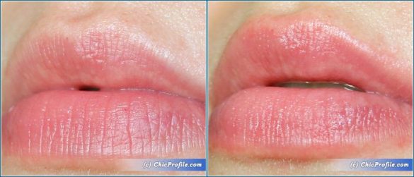 PMD Kiss Lip Plumping System Review, Before & After Photos - Beauty ...